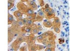 Used in DAB staining on fromalin fixed paraffin-embedded Liver tissue (Emilin1 抗体  (AA 803-1016))