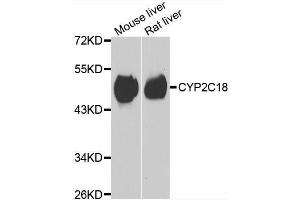 Western blot analysis of extracts of various cell lines, using CYP2C18 antibody. (CYP2C18 抗体  (AA 231-490))
