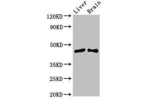 Western Blot Positive WB detected in: Mouse liver tissue, Mouse brain tissue All lanes: SIRT3 antibody at 3.