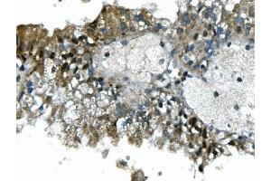 IHC analysis of UBR2 using anti-UBR2 antibody (ABIN7599609).