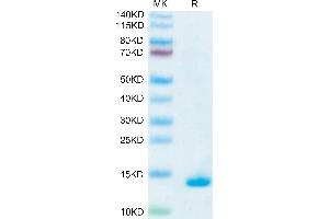 Human Mature TGF beta 1 on Tris-Bis PAGE under reduced condition. (TGFB1 蛋白)