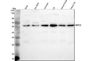 Western blot analysis of NETO2 using anti-NETO2 antibody (ABIN7600760).