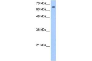 Western Blotting (WB) image for anti-Synovial Apoptosis Inhibitor 1, Synoviolin (SYVN1) antibody (ABIN2462686) (SYVN1 抗体)