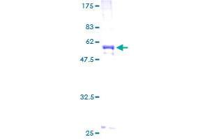 COL2A1 Protein (AA 1-268) (GST tag)