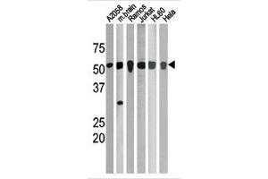 Image no. 1 for anti-Checkpoint Kinase 1 (CHEK1) (pSer280) antibody (ABIN358108) (CHEK1 抗体  (pSer280))