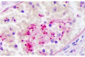 Anti-PPBP antibody IHC staining of human intravascular platelets. (CXCL7 抗体)