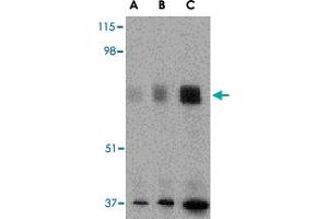 Western blot analysis of MAPKAP1 in human skeletal muscle tissue lysate with MAPKAP1 polyclonal antibody  at (A) 0. (MAPKAP1 抗体  (N-Term))