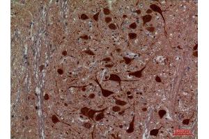 Immunohistochemistry (IHC) image for anti-Hexosaminidase A (HEXA) (Internal Region) antibody (ABIN6281104)