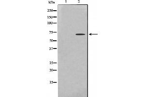 Western blot analysis on HeLa cell lysate using PHF1 Antibody. (PHF1 抗体  (Internal Region))
