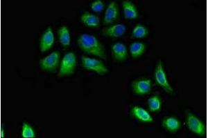 Immunofluorescent analysis of A549 cells using ABIN7155605 at dilution of 1:100 and Alexa Fluor 488-congugated AffiniPure Goat Anti-Rabbit IgG(H+L) (HLA-DRB3 抗体  (AA 111-227))