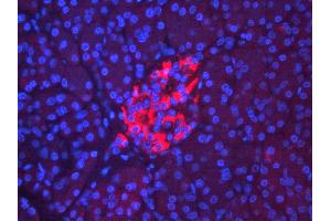 Immunohistochemistry (IHC) image for anti-Receptor-Interacting serine-threonine Kinase 3 (RIPK3) (N-Term) antibody (ABIN2777333)