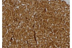 ABIN6274930 at 1/100 staining Rat kidney tissue by IHC-P. (BRWD3 抗体  (C-Term))
