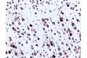 Immunohistochemical staining of pyrimidal cells in a rat cortex, formalin-fixed paraffin-embedded tissue section, with citrate pre-treatment (magnification, 20X) (center). (SNRPN 抗体  (AA 14-174))
