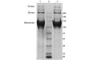 SDS-PAGE (SDS) image for Collagen, Type II, alpha 1 (COL2A1) protein (ABIN5624591)