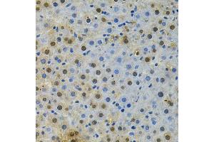 Immunohistochemistry of paraffin-embedded rat liver using BUB1 Antibody (ABIN5970993) at dilution of 1/200 (40x lens). (BUB1 抗体)