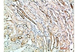 Immunohistochemical analysis of paraffin-embedded human-kidney, antibody was diluted at 1:200 (ART4 抗体  (AA 181-230))