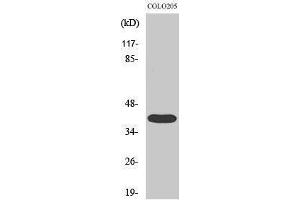 Western Blotting (WB) image for anti-Mitogen-Activated Protein Kinase-Activated Protein Kinase 3 (MAPKAPK3) (C-Term) antibody (ABIN3173584) (MAPKAP Kinase 3 抗体  (C-Term))
