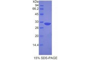 SDS-PAGE analysis of Mouse APAF1 Protein. (APAF1 蛋白)
