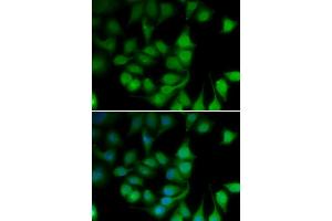 Immunofluorescence analysis of U2OS cells using POLR2H antibody (ABIN6292020). (POLR2H 抗体)