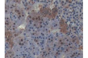 DAB staining on IHC-P; Samples: Rat Adrenal gland Tissue (PLSCR4 抗体  (AA 1-299))