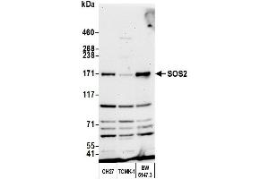 Western Blotting (WB) image for anti-Son of Sevenless Homolog 2 (SOS2) (AA 1282-1332) antibody (ABIN7450757) (SOS2 抗体  (AA 1282-1332))