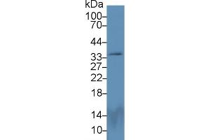 Detection of PEX2 in Rat Cerebrum lysate using Polyclonal Antibody to Peroxisomal Biogenesis Factor 2 (PEX2) (PEX2 抗体  (AA 233-305))