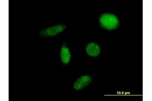 Immunofluorescence (IF) image for anti-Solute Carrier Family 29 (Nucleoside Transporters), Member 2 (SLC29A2) (AA 1-456) antibody (ABIN516583)