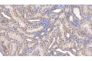 Immunohistochemistry (IHC) image for anti-Peroxiredoxin 3 (PRDX3) (AA 5-233) antibody (ABIN7438094)