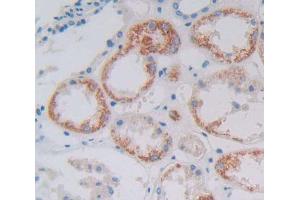 Used in DAB staining on fromalin fixed paraffin- embedded Kidney tissue (GFM1 抗体  (AA 1-158))