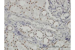 Immunoperoxidase of monoclonal antibody to SF3B2 on formalin-fixed paraffin-embedded human kidney. (SF3B2 抗体  (AA 592-645))