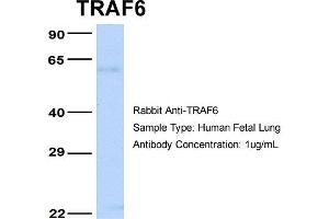 Host: Rabbit Target Name: TRAF6 Sample Type: Human Fetal Lung Antibody Dilution: 1. (TRAF6 抗体  (Middle Region))