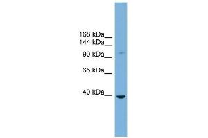 ST14 antibody used at 1 ug/ml to detect target protein. (ST14 抗体)