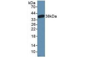 Detection of Recombinant CARD9, Mouse using Polyclonal Antibody to Caspase Recruitment Domain Family, Member 9 (CARD9)