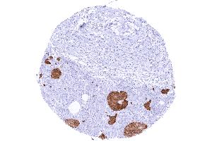 Immunohistochemistry (IHC) image for anti-Glutamate Decarboxylase 2 (Pancreatic Islets and Brain, 65kDa) (GAD2) (AA 6-99) antibody (ABIN7477477)