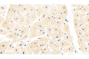 Immunohistochemistry (IHC) image for anti-Interleukin 1 Receptor-Like 1 (IL1RL1) (AA 162-349) antibody (ABIN7437368)