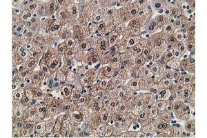 Immunohistochemical staining of paraffin-embedded Human liver tissue using anti-FLYWCH2 mouse monoclonal antibody. (FLYWCH2 抗体)