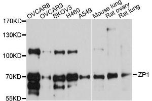 Western blot analysis of extracts of various cell lines, using ZP1 antibody (ABIN5999216) at 1/1000 dilution. (ZP1 抗体)