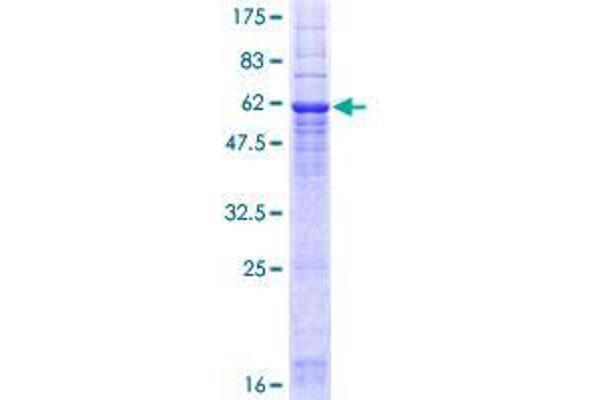 G6PC3 Protein (AA 1-346) (GST tag)