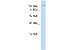 WB Suggested Anti-ZMYM4 Antibody Titration:  0. (ZMYM4 抗体  (N-Term))