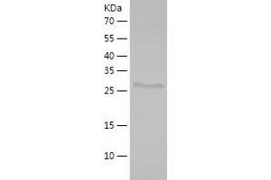 Western Blotting (WB) image for alpha-Methylacyl-CoA Racemase (AMACR) (AA 171-382) protein (His tag) (ABIN7121802) (AMACR Protein (AA 171-382) (His tag))