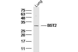Mouse lung lysates probed with BST2/CD317 Polyclonal Antibody, unconjugated  at 1:300 overnight at 4°C followed by a conjugated secondary antibody at 1:10000 for 90 minutes at 37°C. (BST2 抗体  (AA 1-20))