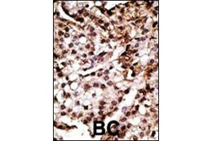 Immunohistochemistry (Paraffin-embedded Sections) (IHC (p)) image for anti-ATG7 Autophagy Related 7 (ATG7) (AA 22-51), (N-Term) antibody (ABIN388520)
