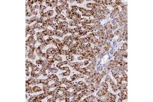 Immunohistochemical staining of human liver with SPINK9 polyclonal antibody  shows strong cytoplasmic positivity in hepatocytes at 1:20-1:50 dilution. (SPINK9 抗体)