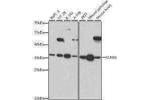 Western blot analysis of extracts of various cell lines, using KCNK6 antibody (ABIN7269467) at 1:1000 dilution. (KCNK6 抗体  (AA 254-313))
