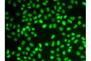 Immunofluorescence (IF) image for anti-Hepatoma-Derived Growth Factor (HDGF) antibody (ABIN1876535) (HDGF 抗体)