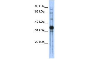 Chondroadherin antibody used at 1 ug/ml to detect target protein.
