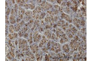 Image no. 1 for anti-Elastase 3A (ELA3A) (AA 16-271) antibody (ABIN599118) (Elastase 3A 抗体  (AA 16-271))