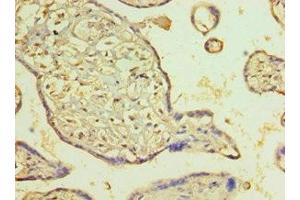 Immunohistochemistry of paraffin-embedded human placenta tissue using ABIN7162721 at dilution of 1:100 (PDLIM1 抗体  (AA 1-329))