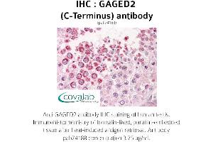Image no. 2 for anti-X Antigen Family, Member 1B (XAGE1B) (C-Term) antibody (ABIN1734558) (XAGE1B/GAGED2 抗体  (C-Term))