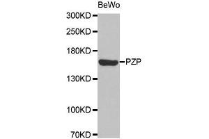 Western blot analysis of extracts of BeWo cell line, using PZP antibody. (PZP 抗体  (AA 620-740))
